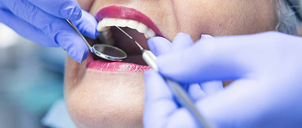 Best Urgent Care for Lost Fillings or Crowns in Seguin, TX